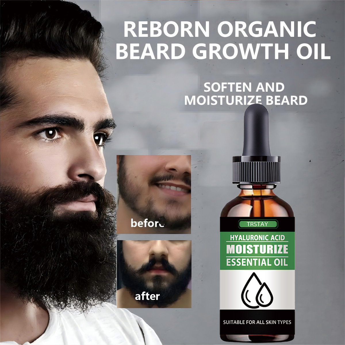 Men'S Grooming Products - 100% Natuurlijke Versnellen Gezichtshaar Groeien Baard